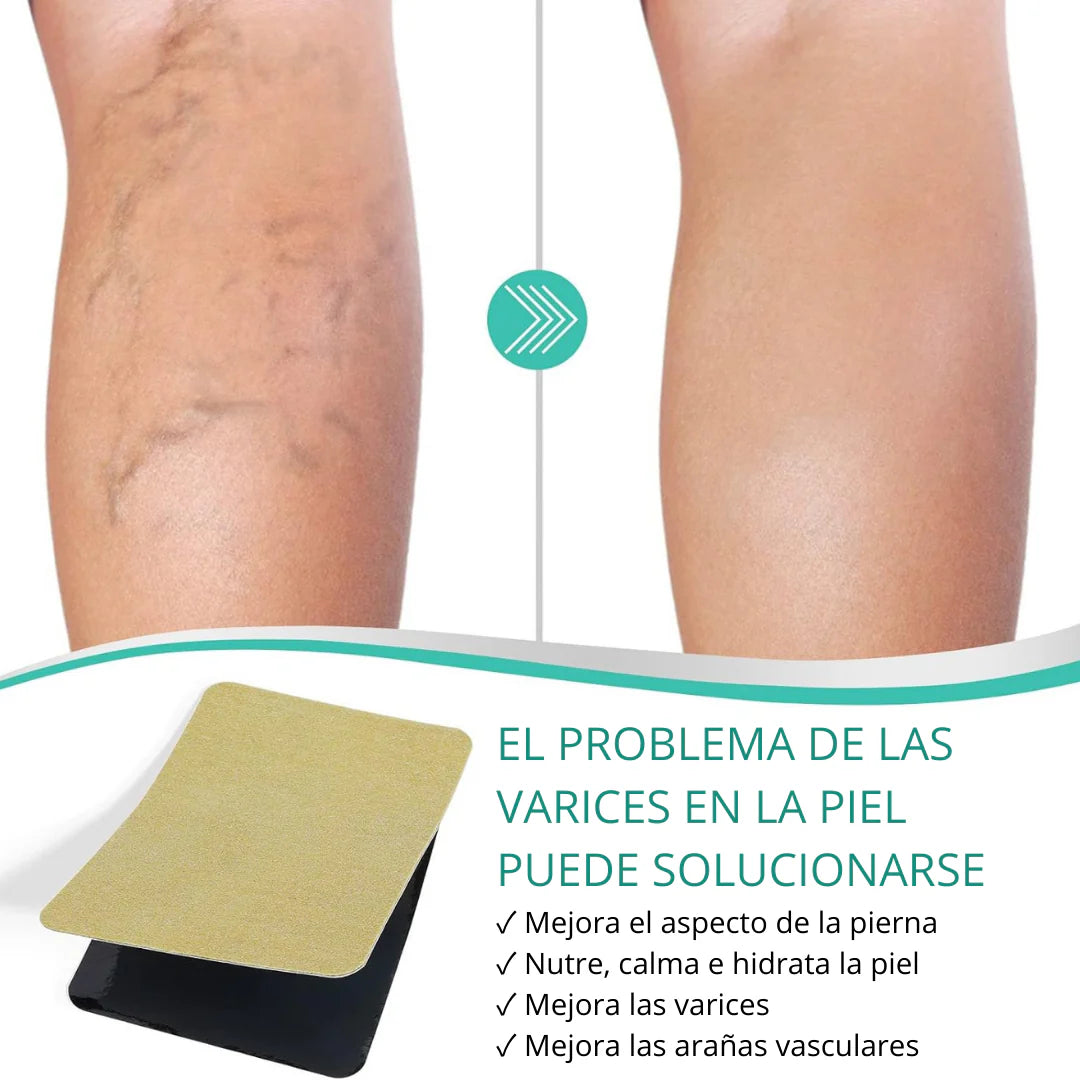 ¡Deshazte de las Varices sin Dificultad! 🩹 Resultados Notables + Envío Sin Costo y Paga al Recibir 🚚