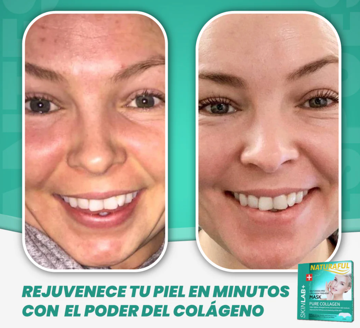 NaturaFul® Parches de Colágeno Absorbentes (8 Piezas) ✨❤️ + ¡ENVÍO GRATIS! 🚚